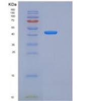 小鼠BACE2 / Beta secretase 2重组蛋白His tag