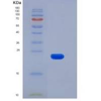 人ULBP2 / N2DL-2重组蛋白His tag