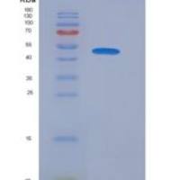 小鼠胶原结构巨噬细胞受体(MARCO)重组蛋白His tag