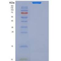 小鼠B/T-淋巴细胞衰减因子(BTLA)重组蛋白Fc tag