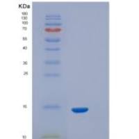 人SIGIRR / TIR8重组蛋白His tag