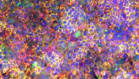 AKITA器官芯片应用：肺泡上皮-内皮屏障芯片_曼博生物