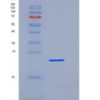人亲环素A（Cyclophilin A）重组蛋白His Tag