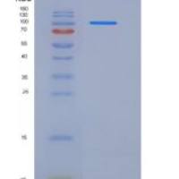 大鼠VEGFR2 / Flk-1 / CD309 / KDR重组蛋白Fc tag