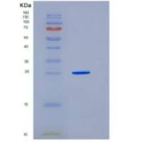 人组成性雄烷受体(CAR)重组蛋白His tag