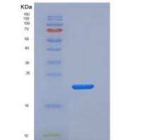 小鼠KIM-1 / TIM1 / HAVCR1重组蛋白His tag