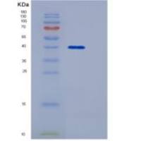 人SIGIRR / TIR8重组蛋白Fc tag