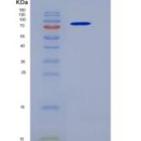 小鼠Prolyl endopeptidase / PREP重组蛋白His tag