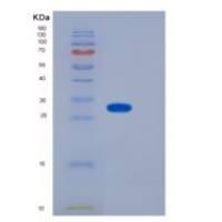 小鼠CD155 / PVR重组蛋白His Tag