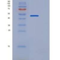 人TNFR2 / CD120b / TNFRSF1B重组蛋白His & Fc tag