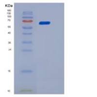 小鼠CD155 / PVR重组蛋白His & Fc tag
