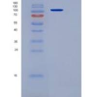 小鼠血管紧张素转化酶2(ACE2)重组蛋白His & Fc tag