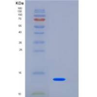 人TSPAN8 / Tetraspanin 8 / TM4SF3重组蛋白His tag