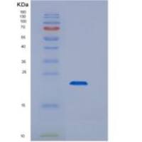 人CD44重组蛋白His tag