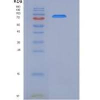 人肝配蛋白B受体2(EPHB2)重组蛋白His & Fc tag