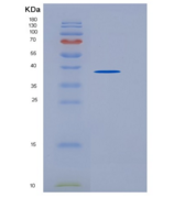 小鼠野鼠色基因相关蛋白(AGRP)重组蛋白Fc tag