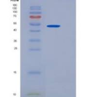人CLEC1A / CLEC-1重组蛋白Fc Tag