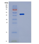 人MSR1 / SCARA1 / CD204重组蛋白His