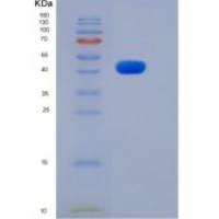 小鼠ROBO4重组蛋白His tag