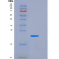 人OX40重组蛋白His Tag