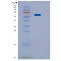 人CADM4 / IGSF4C / NECL-4重组蛋白Fc Tag