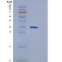 人TNFRSF12A / FN14 / TWEAKR重组蛋白Fc tag
