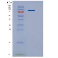 小鼠血管紧张素转化酶2(ACE2)重组蛋白His tag