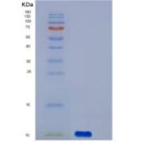 人S100A12 / CAGC / Calgranulin-C重组蛋白