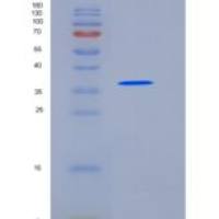 人CCD5L重组蛋白His Tag