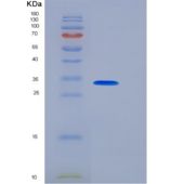 人15-聚谷氨酸脱氢酶(15-PGDH)重组蛋白His Tag
