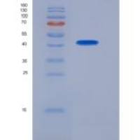 小鼠PPM1A / PP2CA / PP2C-alpha重组蛋白His tag