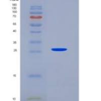人GAP43 / Neuromodulin重组蛋白His tag