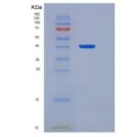 小鼠LRPAP1 / RAP重组蛋白His tag