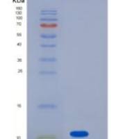人S100A16 / S100F重组蛋白