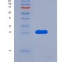 人FOLR2 / FBP重组蛋白His tag