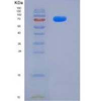 人CD10 / Neprilysin / MME重组蛋白