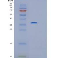 大鼠组织蛋白酶B(CTSB)重组蛋白His Tag