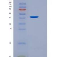 大鼠组织蛋白酶E(CTSE)重组蛋白