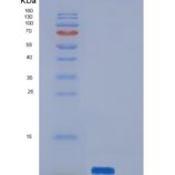 人PI3 / Elafin / WFDC14重组蛋白His tag