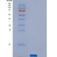 人PI3 / Elafin / WFDC14重组蛋白His tag