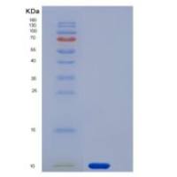 人GYPA / CD235a / Glycophorin A重组蛋白His tag