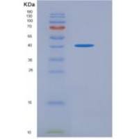 大鼠B/T-淋巴细胞衰减因子(BTLA)重组蛋白ECD, Fc tag