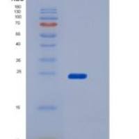 小鼠CD16-2 / FCGR4重组蛋白His & AVI tag