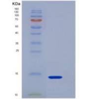 小鼠野鼠色基因相关蛋白(AGRP)重组蛋白His tag