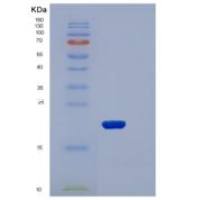 小鼠CLEC4N / CLEC6A / Dectin-2重组蛋白His tag