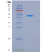 人CEACAM1 / CD66a重组蛋白His tag