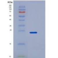 小鼠SLAMF6重组蛋白His Tag