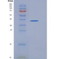 小鼠野鼠色基因相关蛋白(AGRP)重组蛋白Fc tag