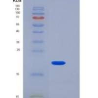 小鼠VSIG4重组蛋白His tag