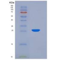 小鼠CD25重组蛋白His Tag